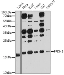 Anti-PFDN2 antibody used in Western Blot (WB). GTX64950
