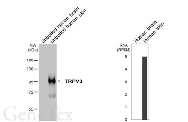 Anti-TRPV3 antibody [HL6778] used in Western Blot (WB). GTX649509