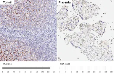 Anti-CD21 antibody [HL6786] used in IHC (Paraffin sections) (IHC-P). GTX649517
