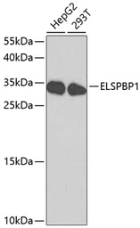 Anti-ELSPBP1 antibody used in Western Blot (WB). GTX64952