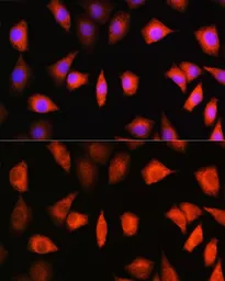 Anti-KAP3 antibody used in Immunocytochemistry/ Immunofluorescence (ICC/IF). GTX64954