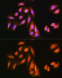 Anti-KAP3 antibody used in Immunocytochemistry/ Immunofluorescence (ICC/IF). GTX64954
