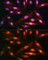 Anti-KAP3 antibody used in Immunocytochemistry/ Immunofluorescence (ICC/IF). GTX64954