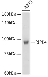 Anti-RIPK4 antibody used in Western Blot (WB). GTX64956
