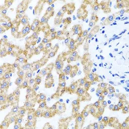 Anti-RIPK4 antibody used in IHC (Paraffin sections) (IHC-P). GTX64956