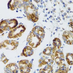 Anti-RIPK4 antibody used in IHC (Paraffin sections) (IHC-P). GTX64956