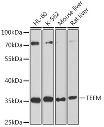 Anti-TEFM antibody used in Western Blot (WB). GTX64957