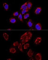 Anti-TEFM antibody used in Immunocytochemistry/ Immunofluorescence (ICC/IF). GTX64957