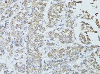 Anti-TEFM antibody used in IHC (Paraffin sections) (IHC-P). GTX64957
