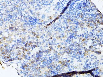 Anti-TEFM antibody used in IHC (Paraffin sections) (IHC-P). GTX64957