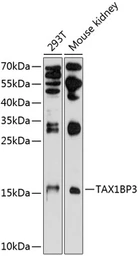 Anti-TAX1BP3 antibody used in Western Blot (WB). GTX64958