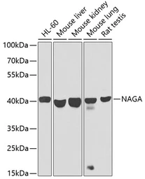 Anti-NAGA antibody used in Western Blot (WB). GTX64961
