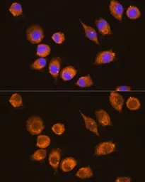 Anti-NAGA antibody used in Immunocytochemistry/ Immunofluorescence (ICC/IF). GTX64961