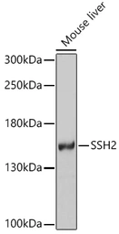 Anti-SSH2 antibody used in Western Blot (WB). GTX64962