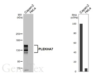 Anti-PLEKHA7 antibody [HL6807] used in Western Blot (WB). GTX649621