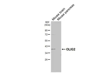 Anti-OLIG2 antibody [HL6811] used in Western Blot (WB). GTX649625