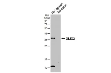 Anti-OLIG2 antibody [HL6811] used in Western Blot (WB). GTX649625