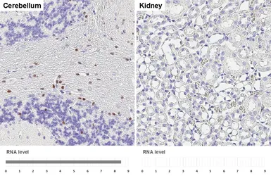 Anti-OLIG2 antibody [HL6811] used in IHC (Paraffin sections) (IHC-P). GTX649625