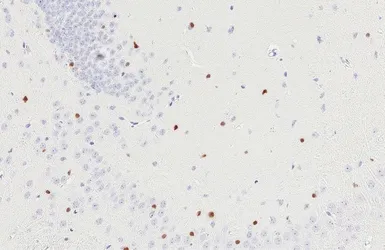 Anti-OLIG2 antibody [HL6811] used in IHC (Paraffin sections) (IHC-P). GTX649625