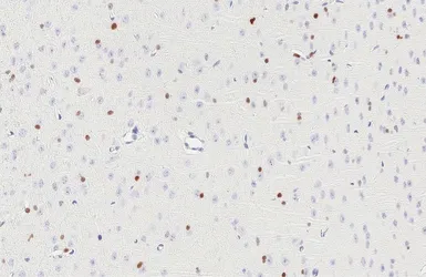 Anti-OLIG2 antibody [HL6811] used in IHC (Paraffin sections) (IHC-P). GTX649625
