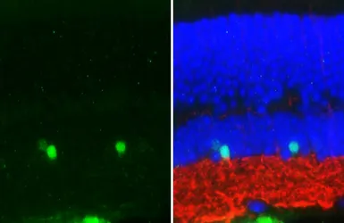 Anti-Parvalbumin antibody [HL6815] used in IHC (Paraffin sections) (IHC-P). GTX649629