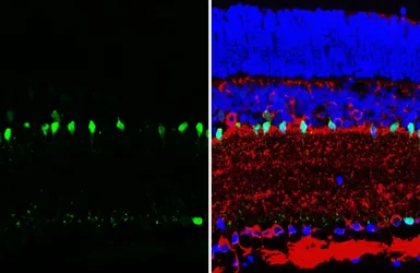 Anti-Parvalbumin antibody [HL6815] used in IHC (Paraffin sections) (IHC-P). GTX649629