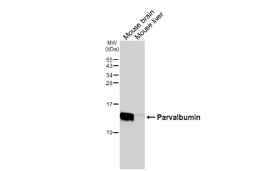 Anti-Parvalbumin antibody [HL6816] used in Western Blot (WB). GTX649630