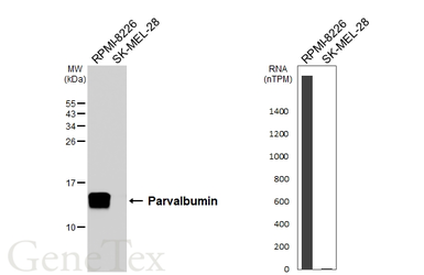 Anti-Parvalbumin antibody [HL6816] used in Western Blot (WB). GTX649630
