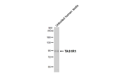 Anti-TAS1R1 antibody [HL6823] used in Western Blot (WB). GTX649637