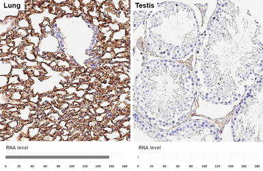 Anti-ICAM1 / CD54 antibody [HL6827] used in IHC (Paraffin sections) (IHC-P). GTX649641