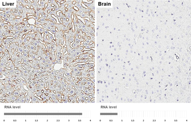 Anti-ICAM1 / CD54 antibody [HL6827] used in IHC (Paraffin sections) (IHC-P). GTX649641