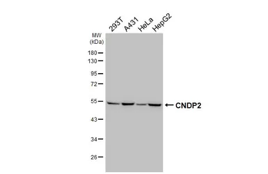 Anti-CNDP2 antibody [HL6833] used in Western Blot (WB). GTX649647