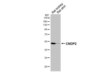 Anti-CNDP2 antibody [HL6833] used in Western Blot (WB). GTX649647