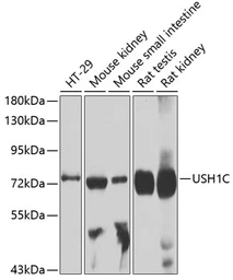 Anti-USH1C antibody used in Western Blot (WB). GTX64965