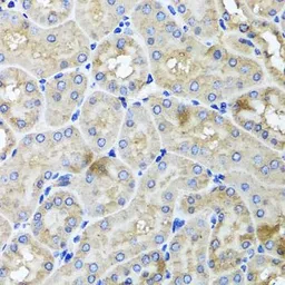 Anti-USH1C antibody used in IHC (Paraffin sections) (IHC-P). GTX64965