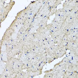 Anti-USH1C antibody used in IHC (Paraffin sections) (IHC-P). GTX64965