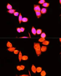 Anti-DNAJC19 antibody used in Immunocytochemistry/ Immunofluorescence (ICC/IF). GTX64966