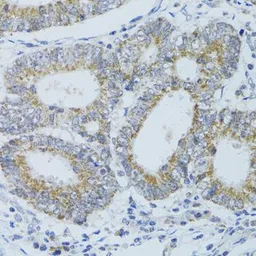 Anti-DNAJC19 antibody used in IHC (Paraffin sections) (IHC-P). GTX64966