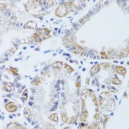 Anti-DNAJC19 antibody used in IHC (Paraffin sections) (IHC-P). GTX64966