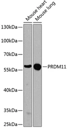 Anti-PRDM11 antibody used in Western Blot (WB). GTX64967