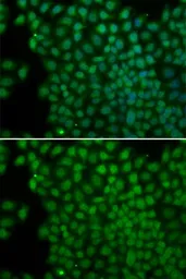Anti-POLR1C antibody used in Immunocytochemistry/ Immunofluorescence (ICC/IF). GTX64968
