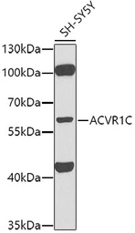 Anti-Activin Receptor Type IC antibody used in Western Blot (WB). GTX64969