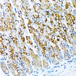 Anti-Activin Receptor Type IC antibody used in IHC (Paraffin sections) (IHC-P). GTX64969