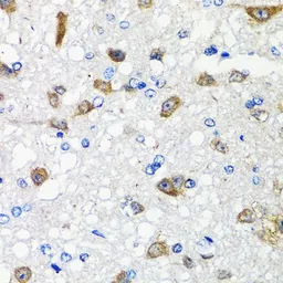 Anti-Activin Receptor Type IC antibody used in IHC (Paraffin sections) (IHC-P). GTX64969