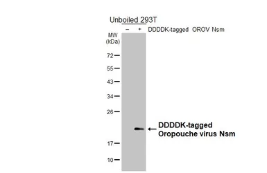 Anti-Oropouche virus Nsm antibody [HL6855] used in Western Blot (WB). GTX649699