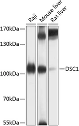 Anti-DSC1 antibody used in Western Blot (WB). GTX64970