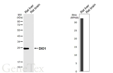 Anti-DIO1 antibody [HL6861] used in Western Blot (WB). GTX649705