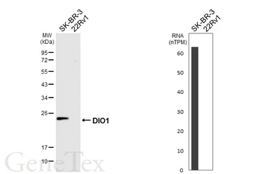 Anti-DIO1 antibody [HL6861] used in Western Blot (WB). GTX649705