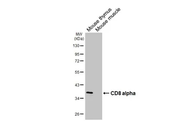 Anti-CD8 alpha antibody [HL6867] used in Western Blot (WB). GTX649711