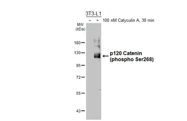 Anti-p120 Catenin (phospho Ser268) antibody [HL6869] used in Western Blot (WB). GTX649713